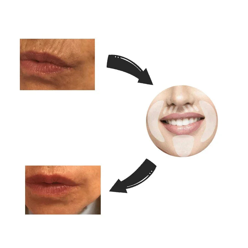 Nuevo botox Libre de Arrugas y Líneas de Expresión 18 Piezas