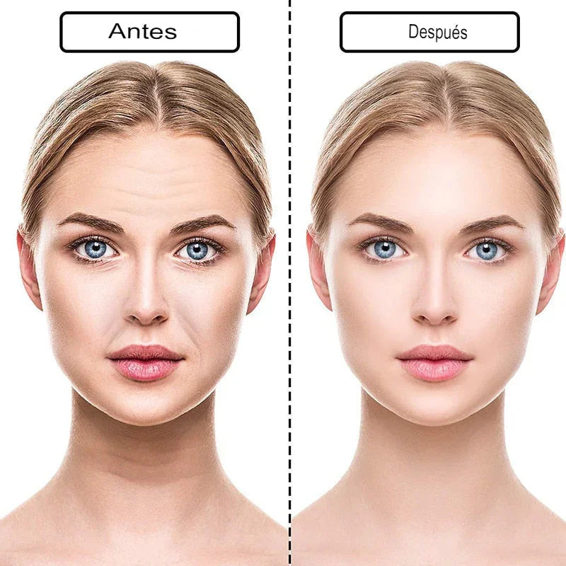 Nuevo botox Libre de Arrugas y Líneas de Expresión 18 Piezas